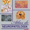 ATLAS DE NEUROPATOLOGIA. VOLUMEN I
