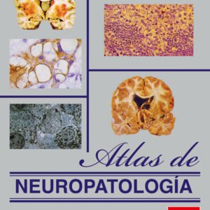 ATLAS DE NEUROPATOLOGIA. VOLUMEN I