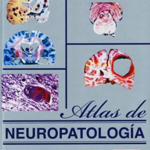 ATLAS DE NEUROPATOLOGIA. VOLUMEN II
