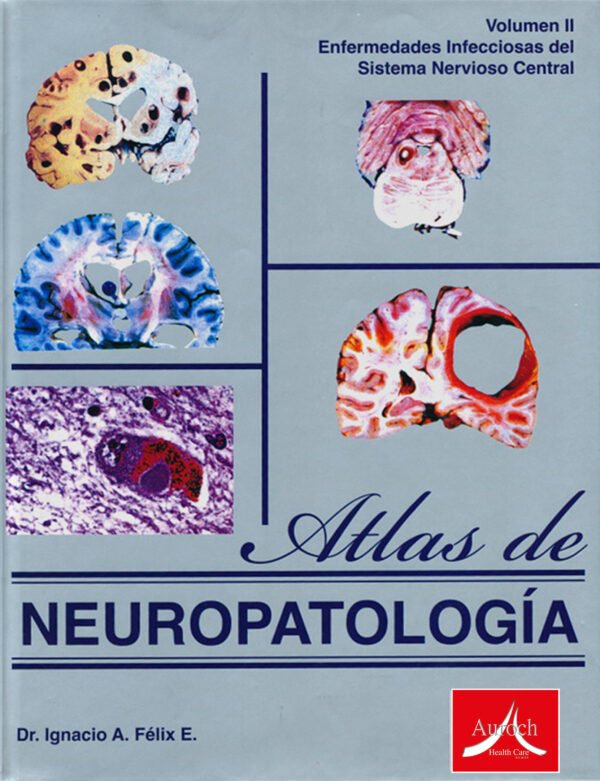 ATLAS DE NEUROPATOLOGIA. VOLUMEN II