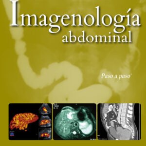 IMAGENOLOGÍA ABDOMINAL: PASO A PASO