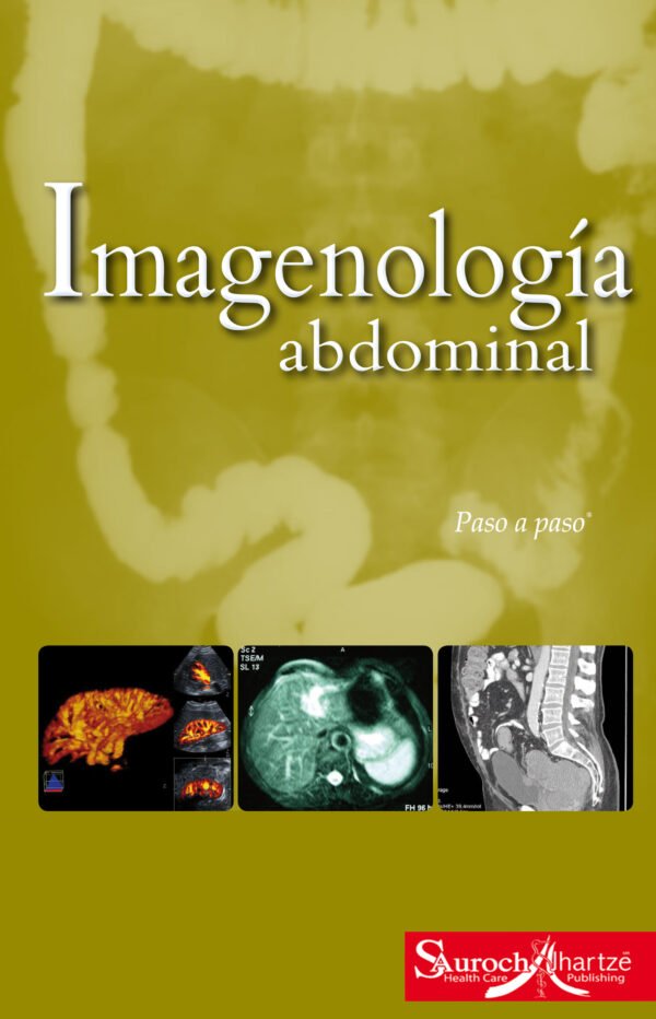 IMAGENOLOGÍA ABDOMINAL: PASO A PASO