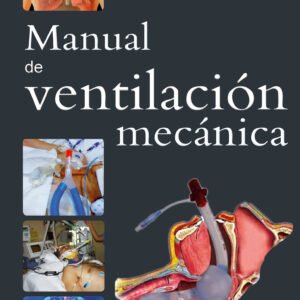 MANUAL DE VENTILACIÓN MECÁNICA