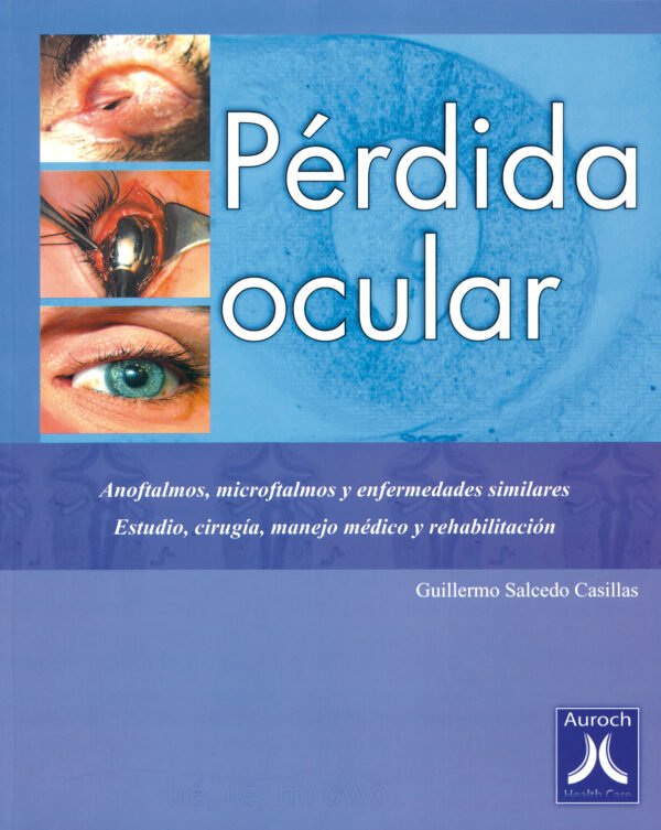 PÉRDIDA OCULAR