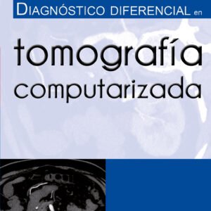 DIAGNOSTICO DIFERENCIAL EN TOMOGRAFÍA COMPUTARIZADA