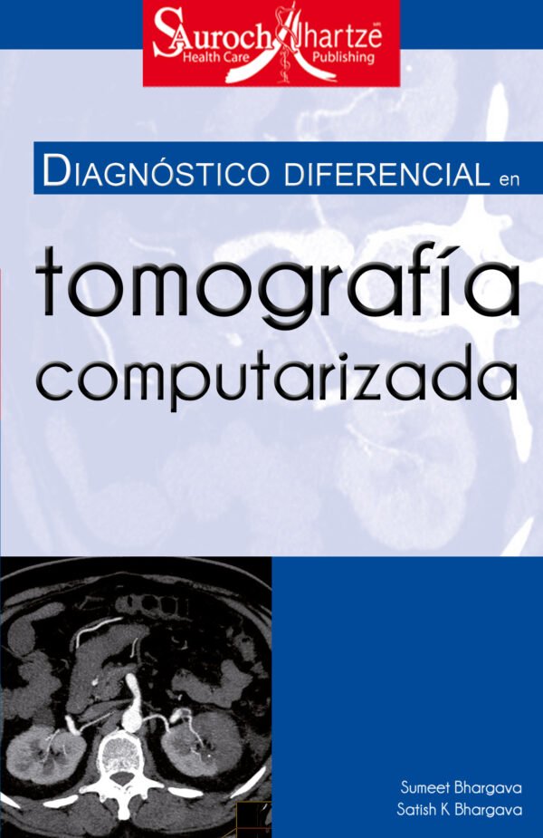 DIAGNOSTICO DIFERENCIAL EN TOMOGRAFÍA COMPUTARIZADA