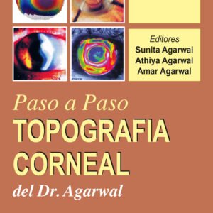TOPOGRAFIA CORNEAL: PASO A PASO