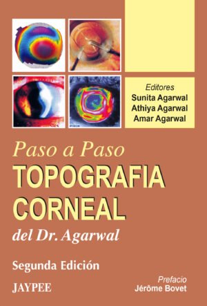 TOPOGRAFIA CORNEAL: PASO A PASO