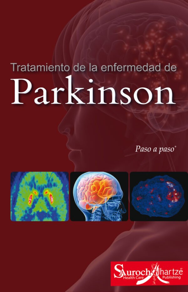 TRATAMIENTO DE LA ENFERMEDAD DE PARKINSON