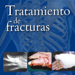 TRATAMIENTO DE FRACTURAS