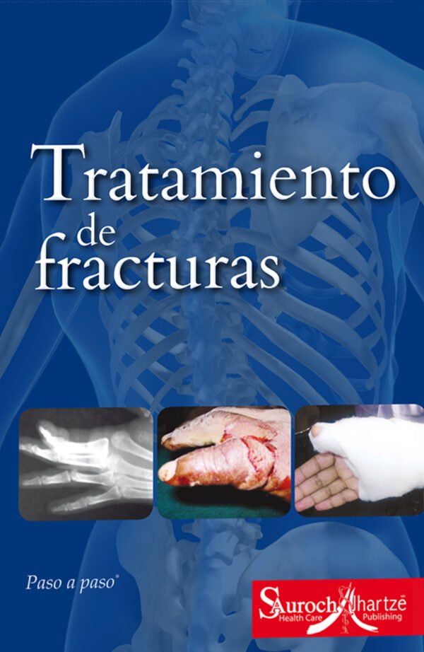 TRATAMIENTO DE FRACTURAS