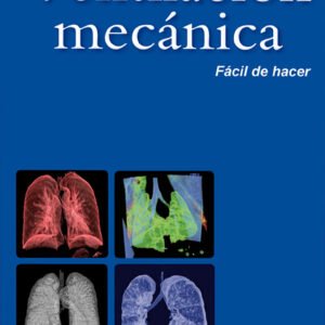 VENTILACIÓN MECÁNICA (FÁCIL DE HACER)