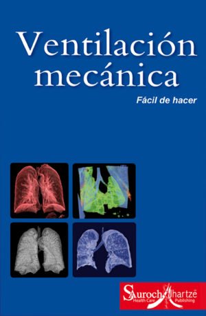 VENTILACIÓN MECÁNICA (FÁCIL DE HACER)